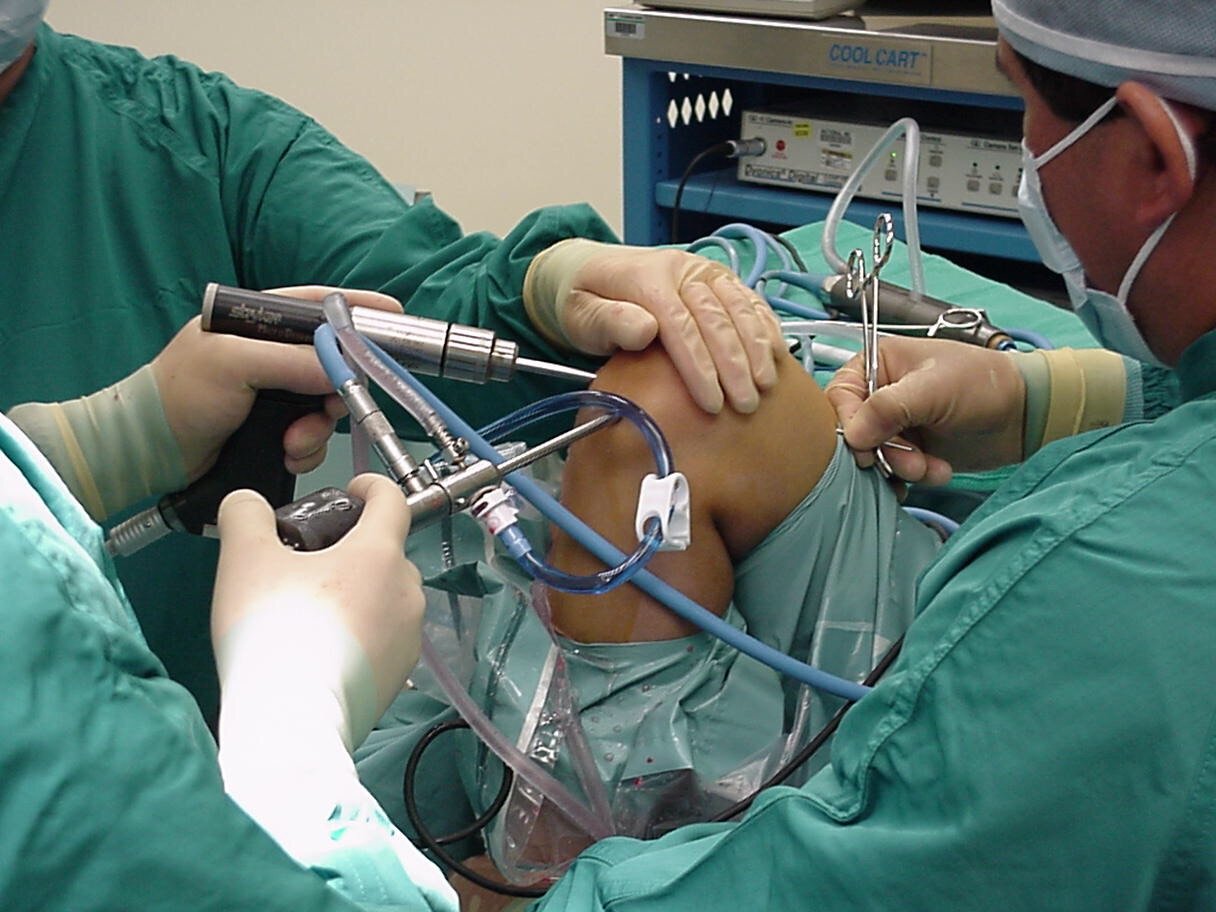 ACL Surgery Procedure