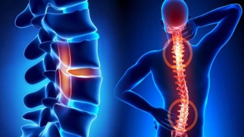 Spine Treatment